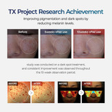 کرم ضد لک و روشن کننده ترانگزامیک اسید دکتر ملاکسین