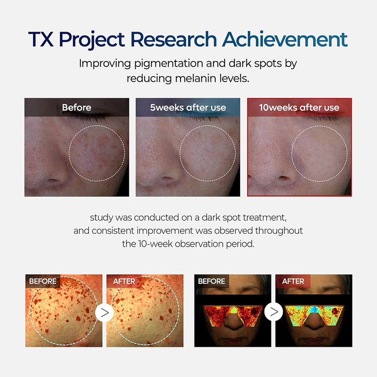 کرم ضد لک و روشن کننده ترانگزامیک اسید دکتر ملاکسین