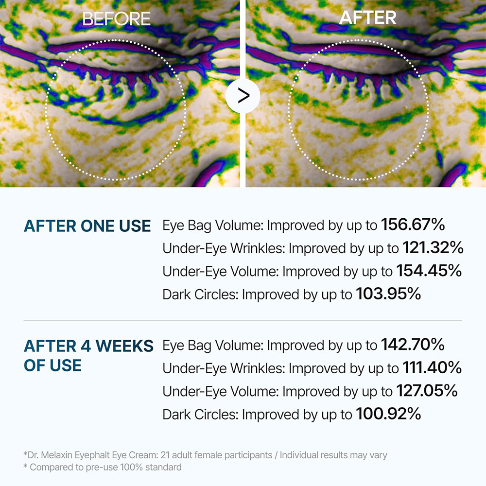 کرم دور چشم ضد چروک و روشن کننده ایفالت دکتر ملاکسین