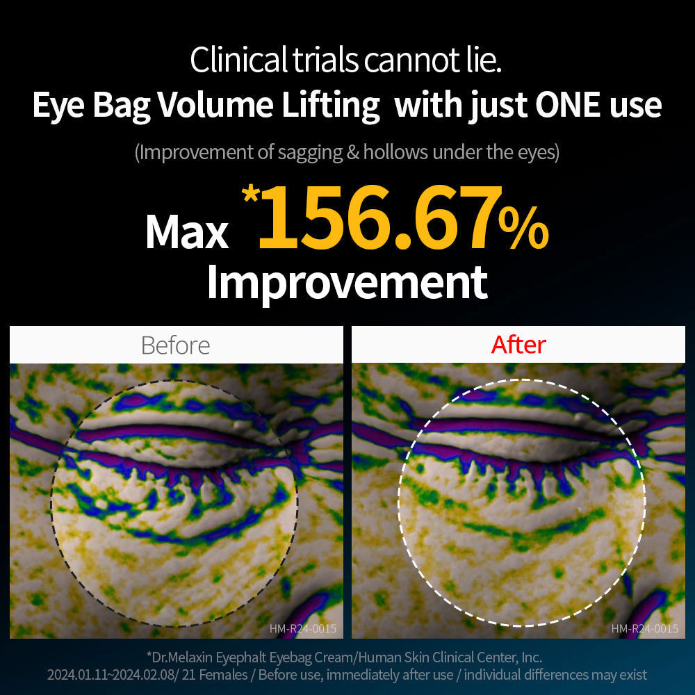 کرم دور چشم ضد چروک و روشن کننده ایفالت دکتر ملاکسین