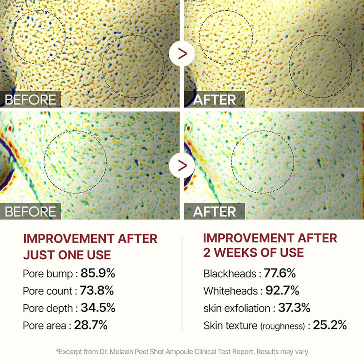 آمپول پیل شات برنج دکتر ملاکسین لایه بردار و روشن کننده پوست