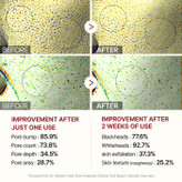 سرم پیل شات برنج سیاه دکتر ملاکسین روشن کننده، لایه بردار و کنترل منافذ پوست