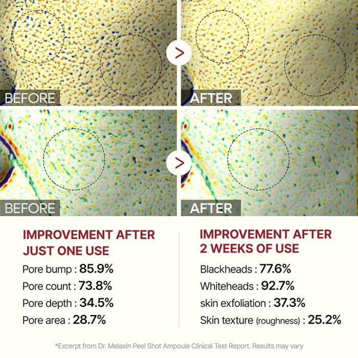 سرم پیل شات برنج سیاه دکتر ملاکسین روشن کننده، لایه بردار و کنترل منافذ پوست