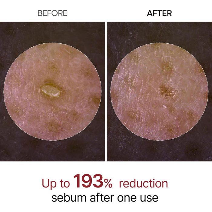 سرم پیل شات برنج سیاه دکتر ملاکسین روشن کننده، لایه بردار و کنترل منافذ پوست