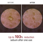 سرم پیل شات برنج سیاه دکتر ملاکسین روشن کننده، لایه بردار و کنترل منافذ پوست