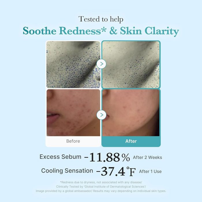 تونر آزلائیک اسید و نیاسینامید مدی کیوب ضدالتهاب، قرمزی و روشن کننده پوست