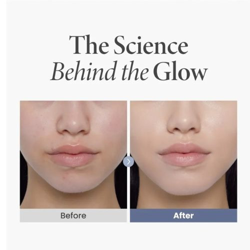 کرم ترانگزامیک اسید 2.5 % اکسیس وای ضد لک و روشن کننده پوست