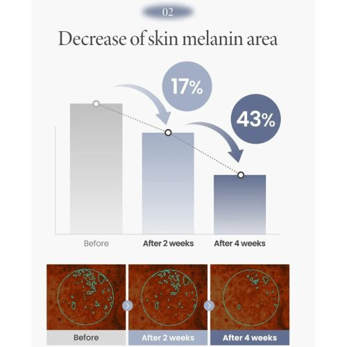 کرم ترانگزامیک اسید 2.5 % اکسیس وای ضد لک و روشن کننده پوست